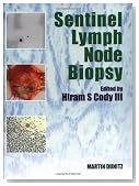 Sentinel Lymph Node Biopsy