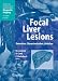 Focal Liver Lesions: Detection, Characterization, Ablation (Medical Radiology / Diagnostic Imaging) 51fCm1b%2BusL. SL75 Laparoscopic Liver Tumor Removal (#3)