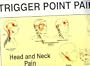 Trigger Points of Pain: Wall Charts (Set of 2)