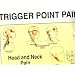 Trigger Points of Pain: Wall Charts (Set of 2)