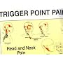 Trigger Points of Pain: Wall Charts (Set of 2)