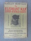The elephant man : a study in human dignity
