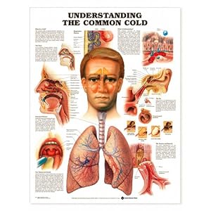 Understanding the Common Cold Anatomical Chart Unmounted by