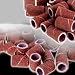 100 SCHLEIFKAPPEN SCHLEIFB�NDER SCHLEIFH�LSEN F�R NAGELFR�SER K�RNUNG 120