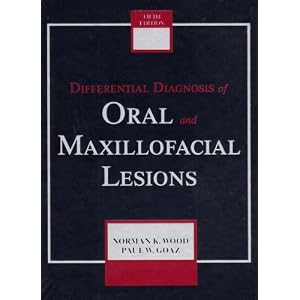 Click here to buy Differential Diagnosis of Oral and Maxillofacial Lesions by Norman K. Wood DDS MS PhD and Paul W. Goaz BS DDS SM.