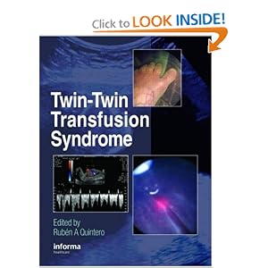 Click here to buy Twin-Twin Transfusion Syndrome by Rub&eacute;n A. Quintero.