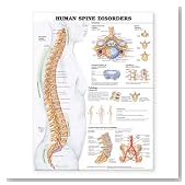 Human Spine Disorders Anatomical Chart