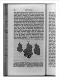 Historic Print (XL): [Normal liver cells, abnormal liver cells that have increased in size, and abnormal live