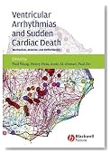 Ventricular Arrhythmias and Sudden Cardiac Death: Mechanism, Ablation, and Defibrillation