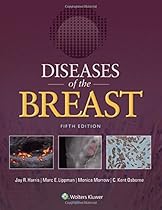 Diseases of the Breast 5e Diseases of the Breast 5e