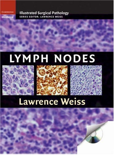 Lymph Nodes (Cambridge Illustrated Surgical Pathology)