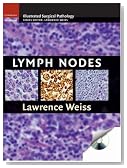 Lymph Nodes (Cambridge Illustrated Surgical Pathology)