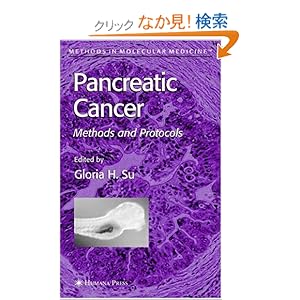 【クリックでお店のこの商品のページへ】Pancreatic Cancer (Methods in Molecular Medicine)