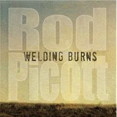 Welding Burns