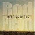 Welding Burns