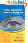 Makuladegeneration, Diabetische Retin...