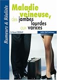 Maladie veineuse, des jambes lourdes aux varices : Rumeurs & R�alit�s
