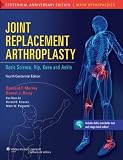 Joint replacement arthroplasty