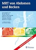 MRT von Abdomen und Becken: Kartonierte Sonderausgabe