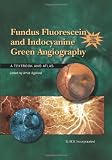 Fundus Fluorescein and Indocyanine Green Angiography: A Textbook and Atlas