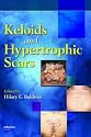 Keloids and Hypertrophic Scars (Basic and Clinical Dermatology)
