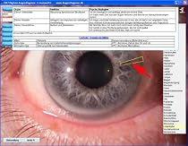 Iridologie Digitale Augendiagnose (Irisdiagnose) DA7 Software