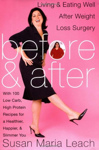 Before and After: Living and Eating Well After Weight Loss Surgery