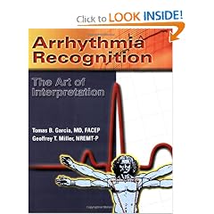 Arrhythmia Recognition: The Art Of Interpretation by Tomas B. Garcia and Geoffrey T. Miller