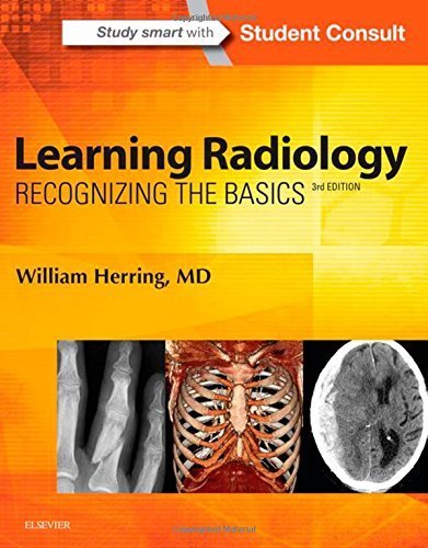 Learning Radiology: Recognizing the Basics, 3e 3rd Edition by Herring MD FACR, William (2015) Paperback