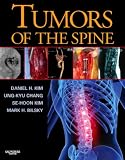 Tumors of the Spine