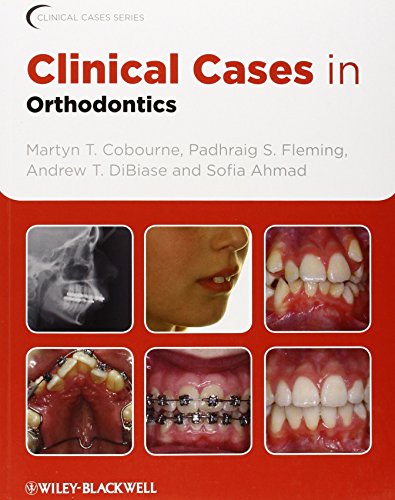 clinical cases in orthodontics