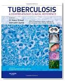 Tuberculosis: A Comprehensive Clinical Reference, 1e