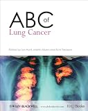 ABC of Lung Cancer (ABC Series)
