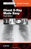 Chest X-Ray Made Easy, 4e Chest X-Ray Made Easy, 4e
