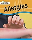 Allergies