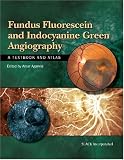 Fundus Fluorescein and Indocyanine Green Angiography: A Textbook and Atlas