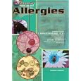 Allergies (21st Century Health and Wellness) by Edward Edelson and C. Everett Koop