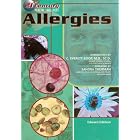 Allergies (21st Century Health and Wellness) by  Edward Edelson and C. Everett Koop