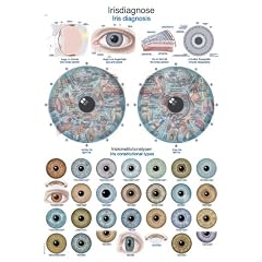 AL526 Erler-Zimmer Lehrtafel Irisdiagnose, 50x70cm