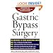 Gastric Bypass Surgery: Everything You Need to Know to Make an Informed Decision
