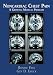 Book Noncardiac Chest Pain (NCCP)--A Growing Medical Problem
