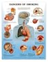 Lww Dangers Of Smoking Anatomical Chart Laminated-9865PL1.5