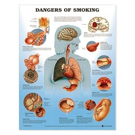 Lww Dangers Of Smoking Anatomical Chart Laminated-9865PL1.5