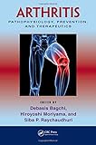Arthritis : pathophysiology, prevention, and therapeutics