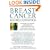 Breast Cancer: Beyond Convention: The World's Foremost Authorities on Complementary and Alternative Medicine Offer Advice on Healing