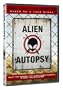 Alien Autopsy