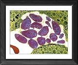 Framed Print of Toxoplasmosis from Science Photo Library