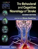 The behavioral and cognitive neurology of stroke