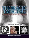 Thoracic Imaging: Pulmonary and Cardiovascular Radiology 2e