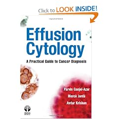 Effusion Cytology: A Practical Guide to Cancer Diagnosis by Parvin Ganjei-Azar MD, Merce Jorda PhD and Awtar Krishan PhD